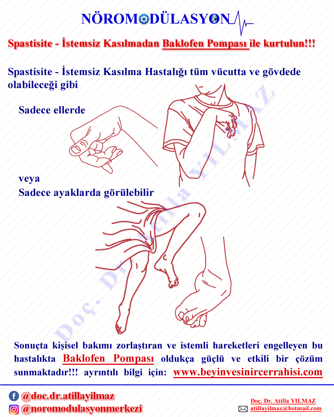 Spastisite - İstemsiz Kasılma