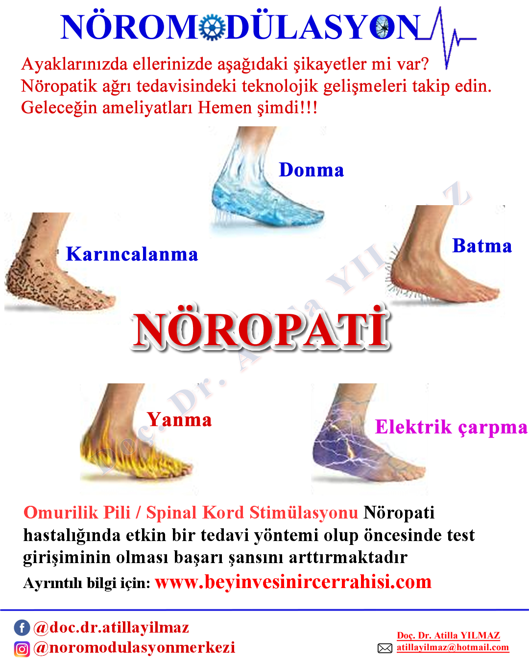 Diyabetik Nöropatik Ağrı