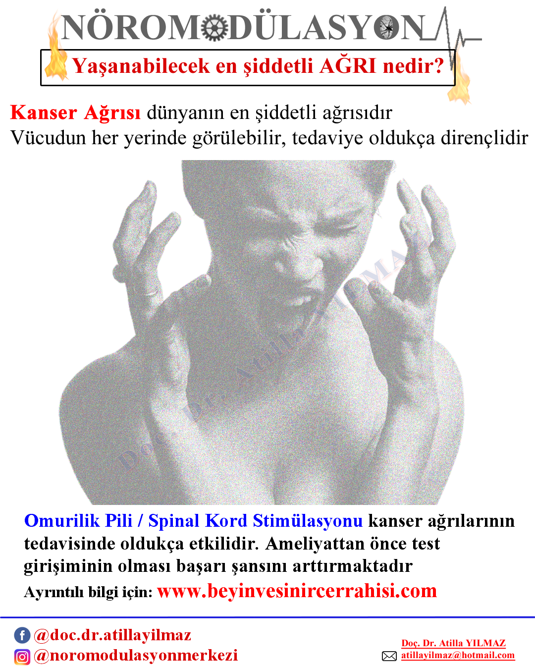 Kanser Ağrısı