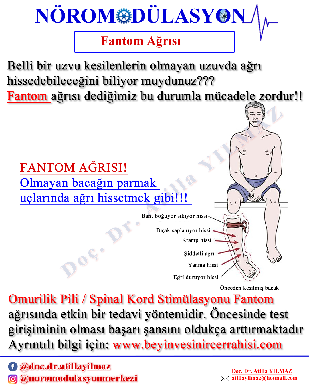 Fantom Ağrısı