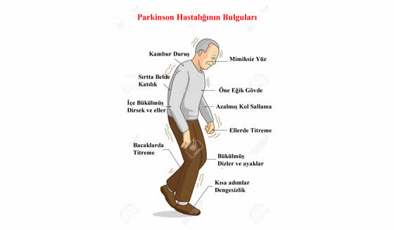 Parkinson Hastalığı