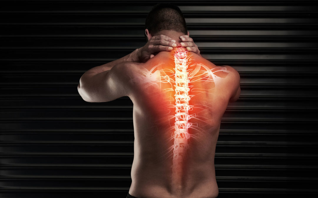 Omurilik Pili - Spinal Kord Stimülasyonu